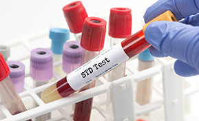 STD Testing Elgin and Algonquin IL